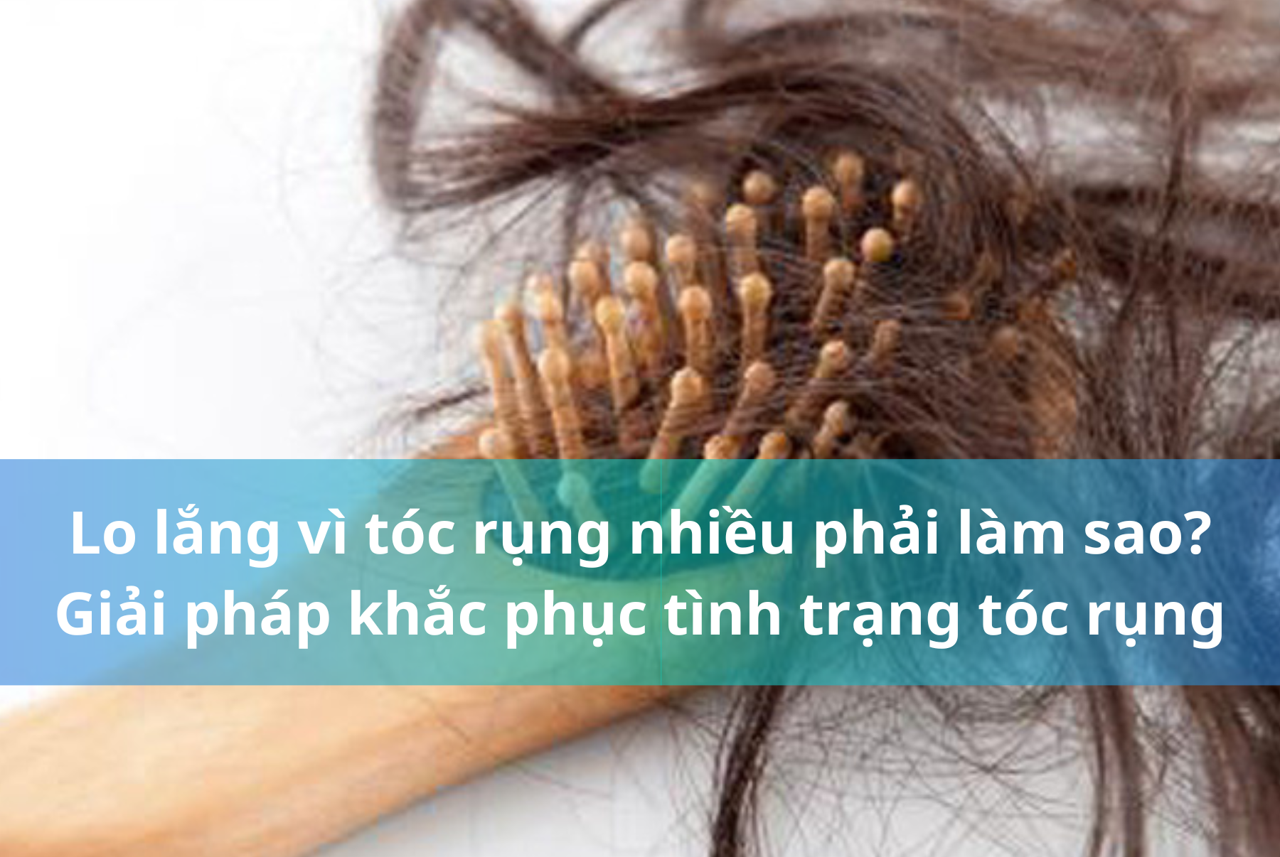 Lo lắng vì tóc rụng nhiều phải làm sao? Và những giải pháp khắc phục hiệu quả tình trạng tóc rụng
